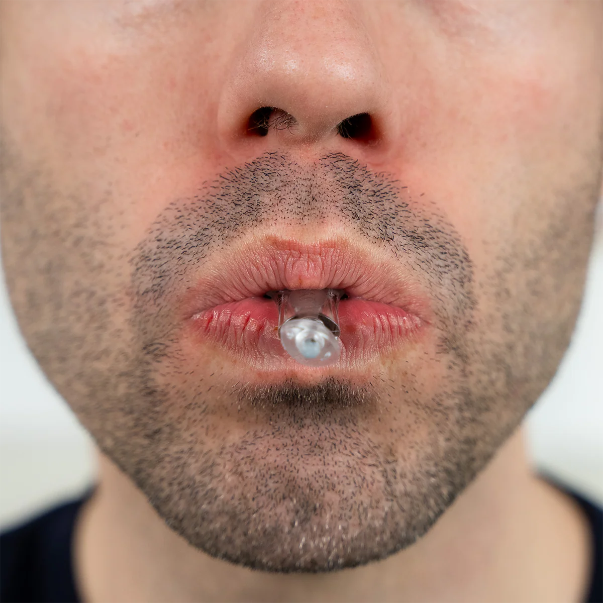 myTAP Oral Appliance for Sleep Apnea - Image 4