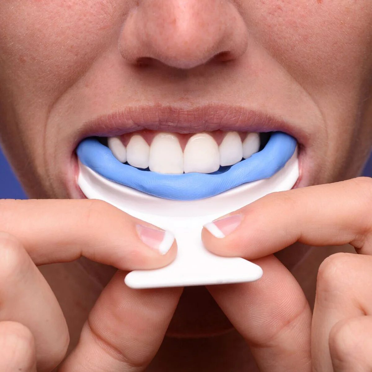 Oral Appliance - Image 8