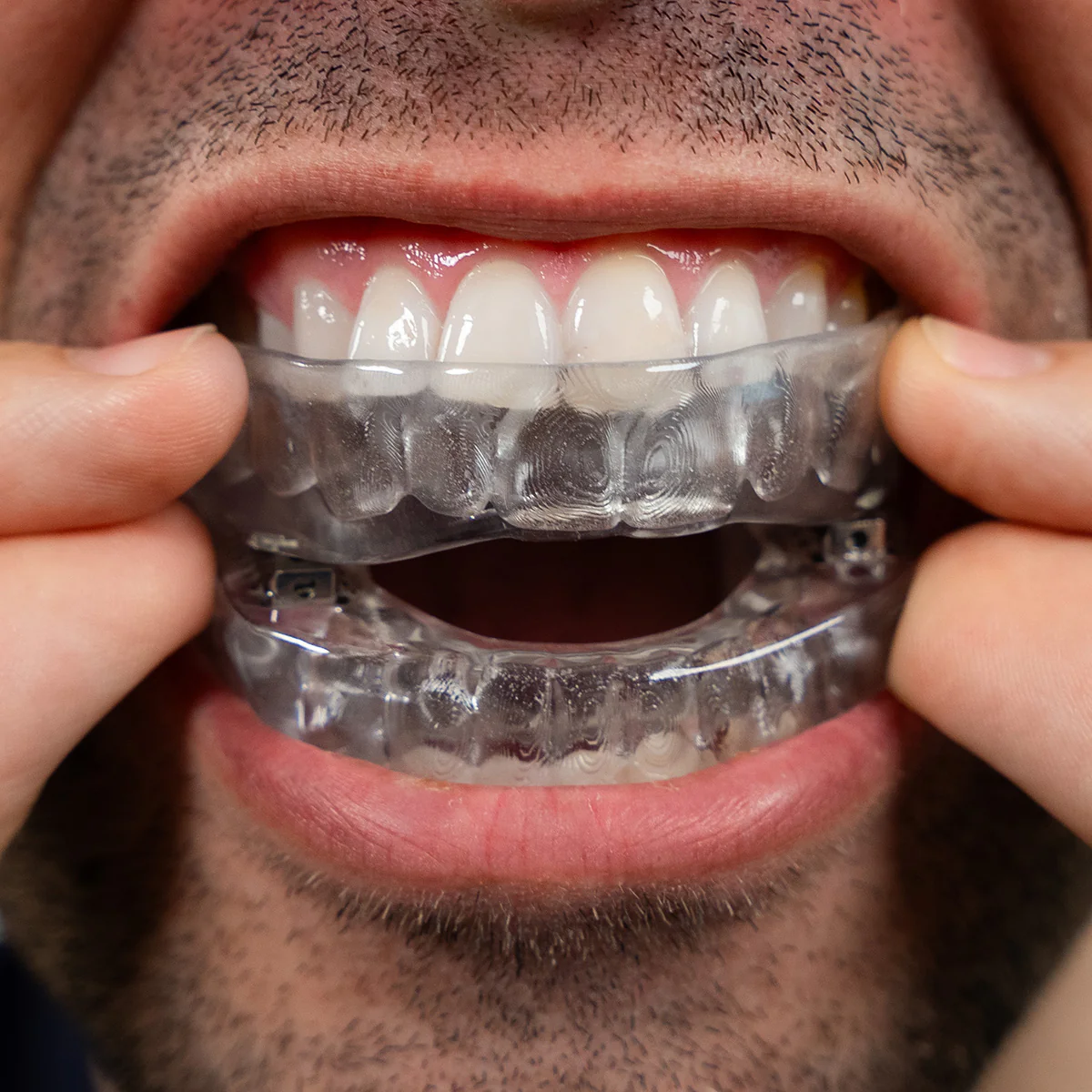 Oral Appliance - Image 9